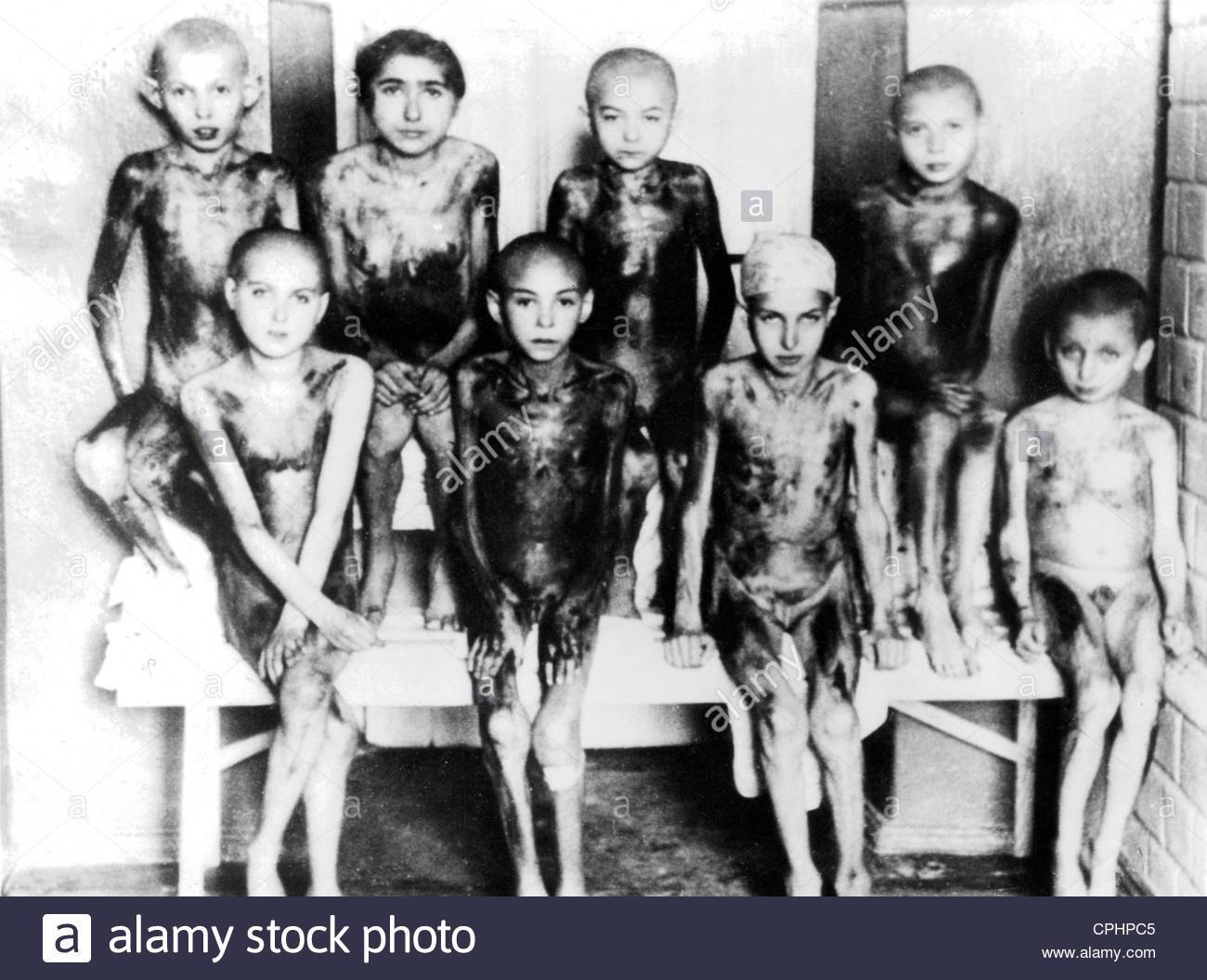 A group of children in Auschwitz. The children have fallen victims of medical experiments and their bodies are covered with burns. EN: